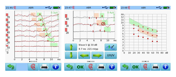 upgrade-module-100424