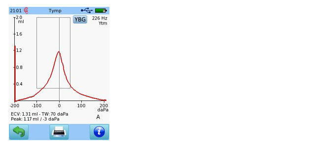 upgrade-module-100560