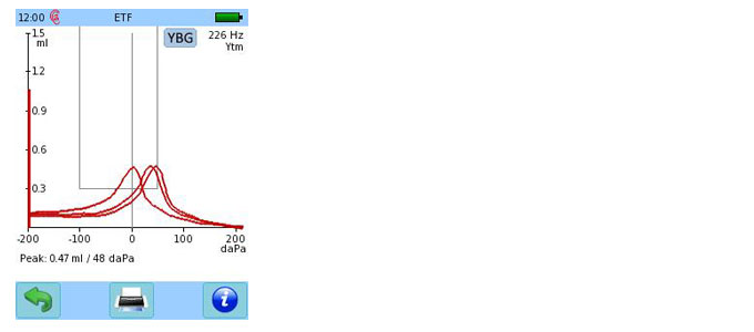 upgrade-module-100913