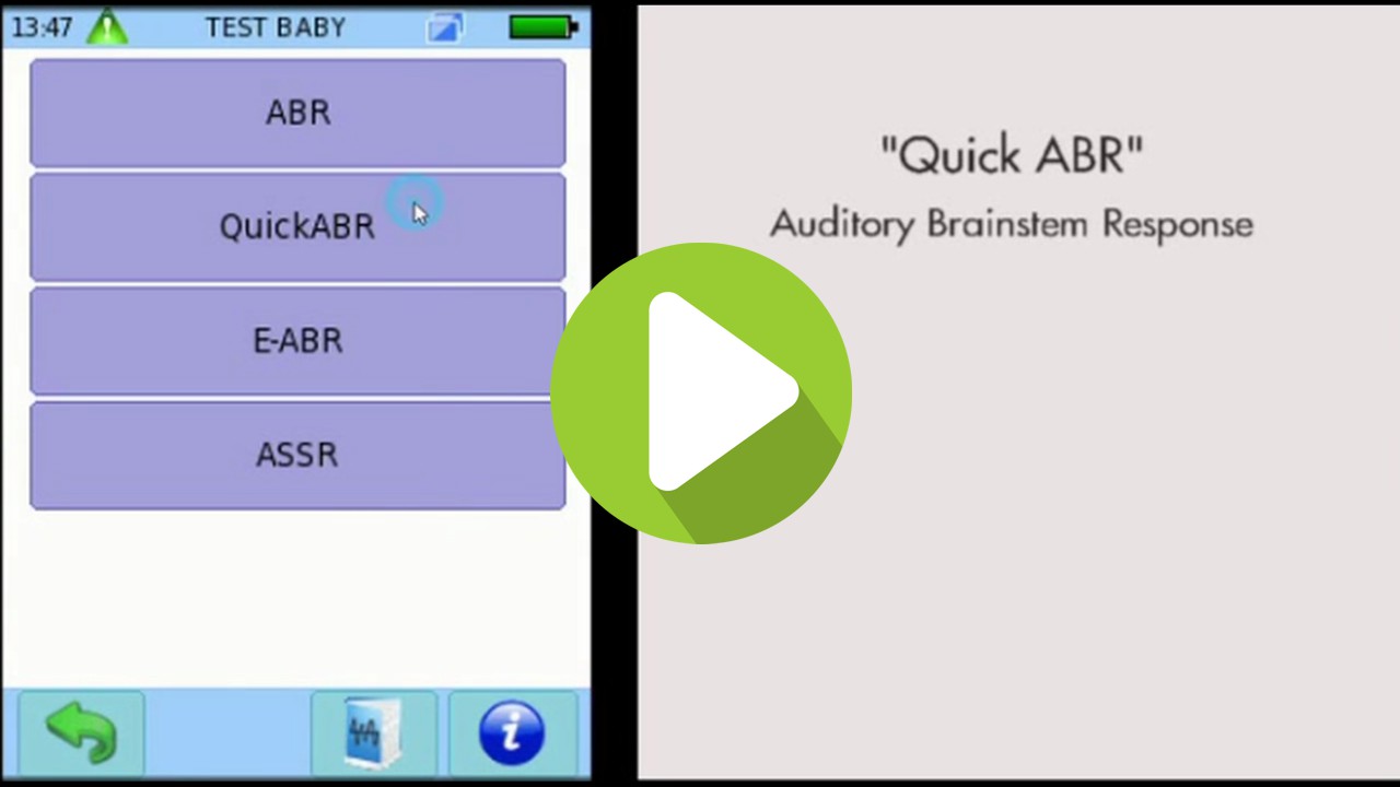 How to configure AABR for neonatal screening on the SENTIERO ADVANCED