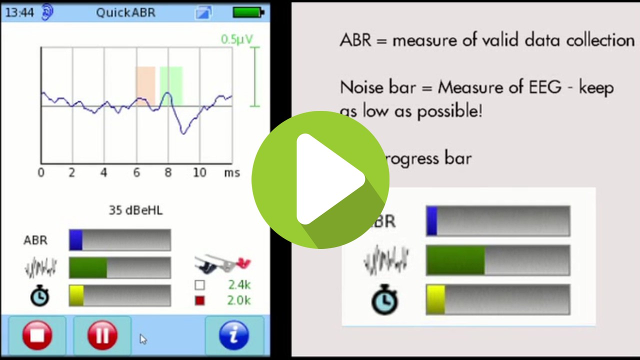 How to run the AABR test for neonatal screening on the SENTIERO ADVANCED