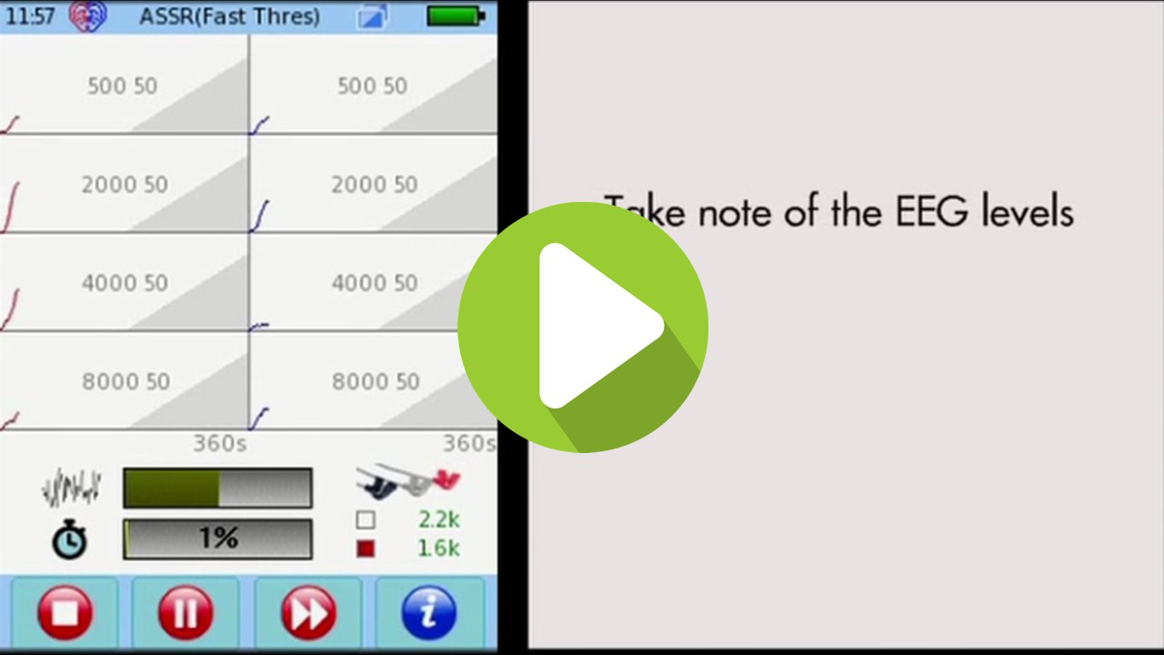Diagnostic ASSR test on the SENTIERO ADVANCED