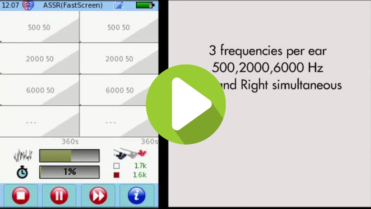 ASSR Screening on the SENTIERO ADVANCED