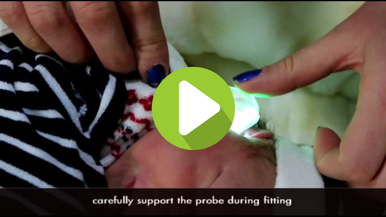 TEOAE Screening on neonate with SENTIERO